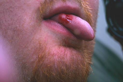 I Pierced Tongue...Take a look.-2658-012.jpg