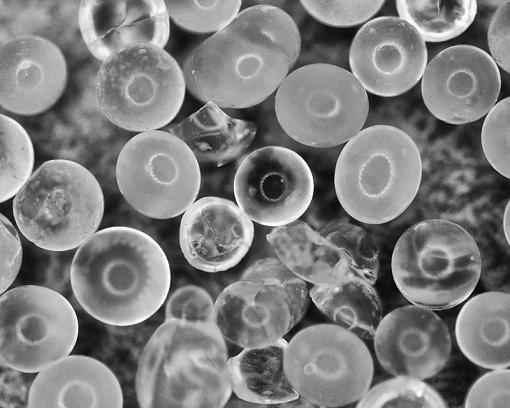 Cells?-bubbles.jpg